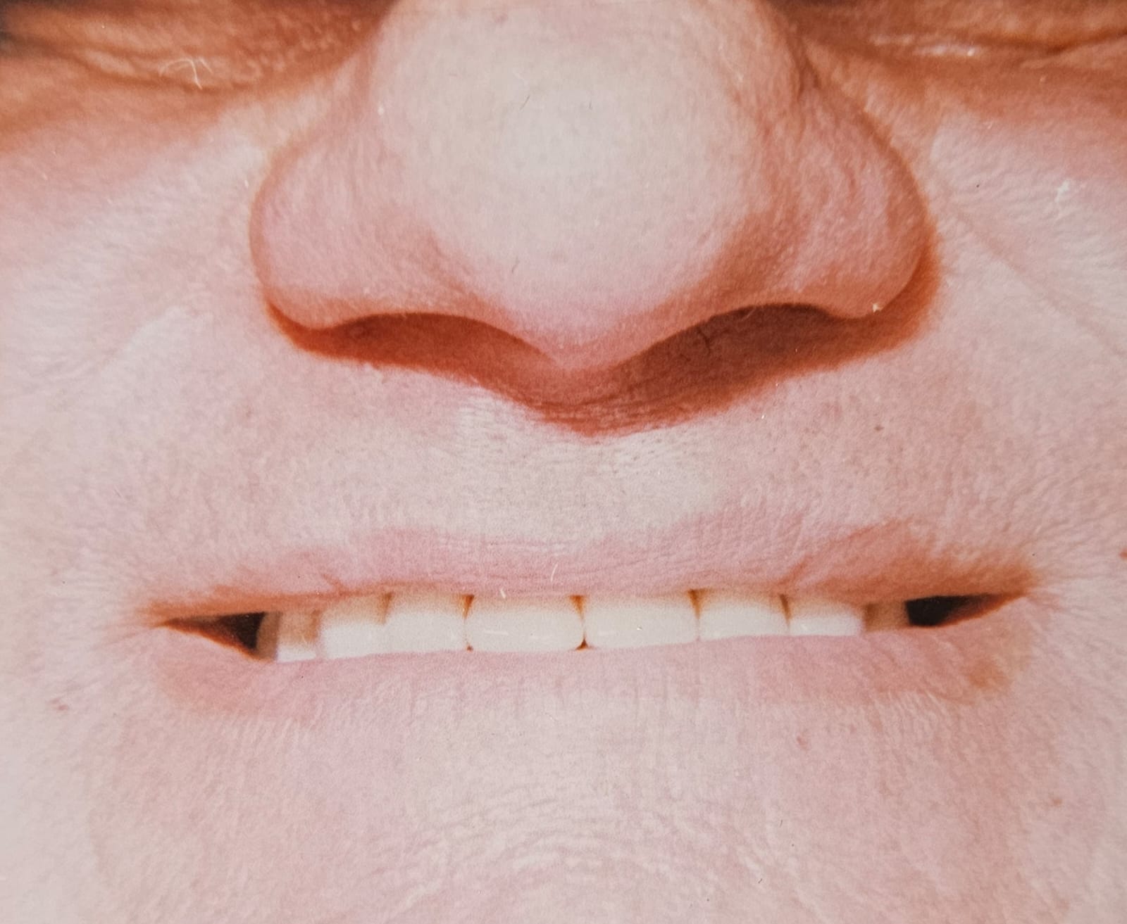 Stage 6 — Final Result